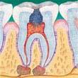 2.2. Tratamento Endodôntico LEONARDO (2005) define a endodontia como a ciência e a arte que envolve etiologia, prevenção, diagnóstico e tratamento das repercussões da polpa dental na região periapical.