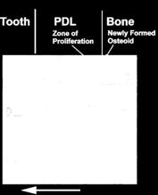 Movimento Ortodontico do dente Notem a quantidade de fluxo sanguineo no Ligamento Periodontal, e a concentração na area de nova deposição óssea 2 tipos Distintos de Dinâmica