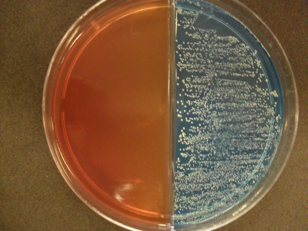 com Abstract - The uroculture is an important exam for human urinary infection level detection. The level is determined by counting the colonies cultivated in Petri Dishes.