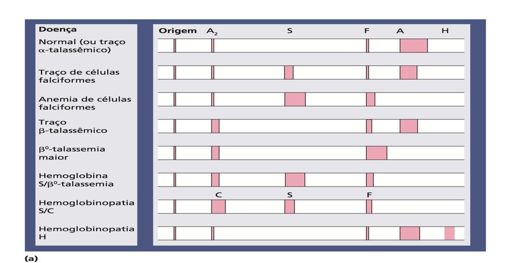 Na imagem 4 mostra os padrões eletroforéticos da hemoglobina em sangue normal e em paciente com traço ou anemia de células falciforme (Hb S), traço