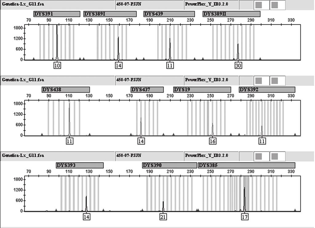 Figure 1 Y-STR electropherograms of the