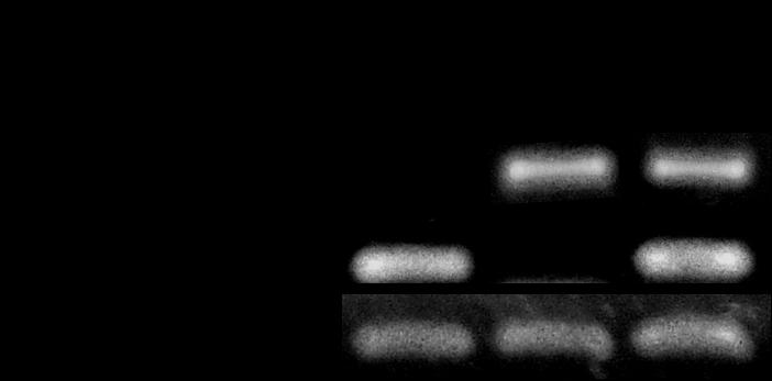 Mutagênese e identificação de fatores de virulência em Brucella ovis Os mutantes gerados a partir de B. ovis foram confirmados através de análise pela PCR (Figura 5). A deleção do gene virb2 de B.