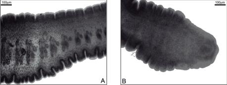 M.I. Müller et al. Registro de B. Cuspidatos em tucunaré 47 intestino, fígado, vesícula biliar, bexiga natatória, gônadas e coração.