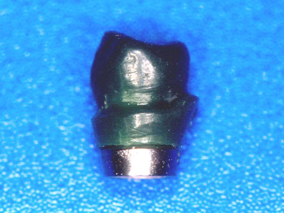Material e Métodos 104 Um análogo de implante (Conexão Sistemas de Prótese) foi incluído em gesso especial tipo IV Durone (Dentsply, Petrópolis, RJ) e sobre ele foi parafusado um abutment fundido.