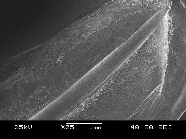 46 A preparação dos espécimes, para posterior análise das superfícies dentinárias à luz da microscopia eletrônica de varredura, principiou por um tratamento de desidratação, por imersão em etanol em