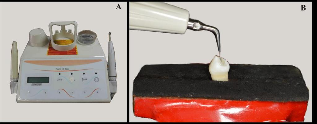 27 Figura 7. A-equipamento utilizado para irrigação ultrassônica passiva. B-inserto em posição durante ativação da irrigação para remoção da pasta de Ca(OH) 2. Fonte: Autor.