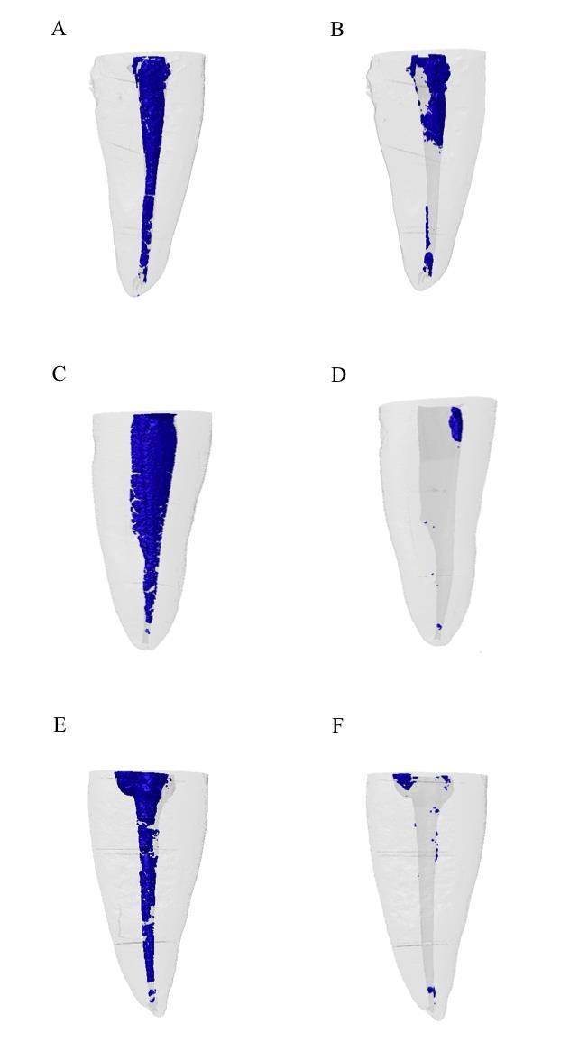 36 36 A representação das imagens utilizadas na análise morfológica tridimensional qualiquantitativa do volume de pasta de Ca(OH)2 pode ser observada na Figura 12.