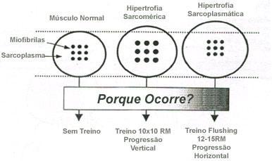 Hipertrofia Muscular