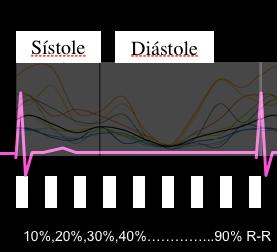 Sincronização ECG