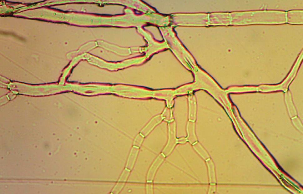 4 A B Figura 3. (A) Hifas do fungo Rhizoctonia solani causador de queima das folhas de muda de palma-de-óleo; (B) Colônia de R. solani com formação de escleródios (seta).