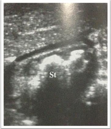 24 A parede do estômago é constituída por cinco camadas, incluindo, superfície da mucosa, mucosa, submucosa, muscular e serosa (FIGURA 10).