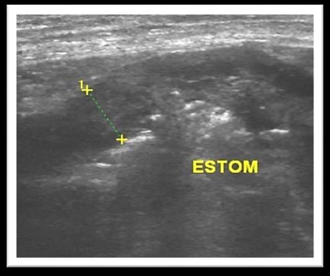 31 Figura 11: Imagem ultrassonográfica do estômago em corte longitudinal (A) e