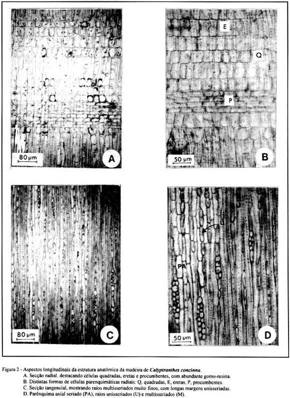 Anatomia da madeira do