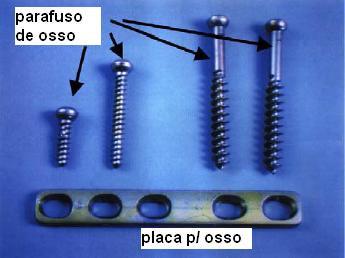 16 são largamente empregados na substituição de tecidos duros como ossos artificiais, junções e implantes dentários. b) Aplicações cardíacas e cardiovasculares.