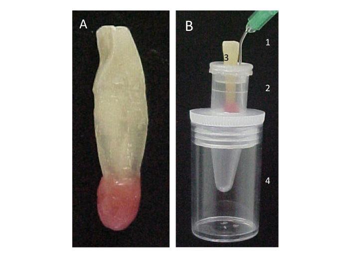 Figura 3- A. Dente incisivo inferior com anteparo de cera rosa 7.B.