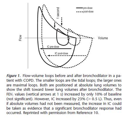 Figura 4: Curvas de débito aéreo antes e após broncodilatação em doente com DPOC. As curvas mais pequenas correspondem ao volume corrente; as maiores ao volume máximo.