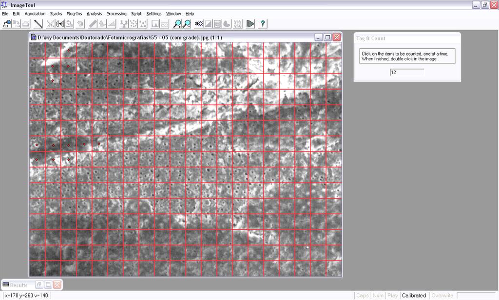 Materiais e métodos 61 Figura 3. Interface gráfica do programa ImageTool v3.0, utilizado para quantificar as áreas da fotomicrografia contendo smear layer.