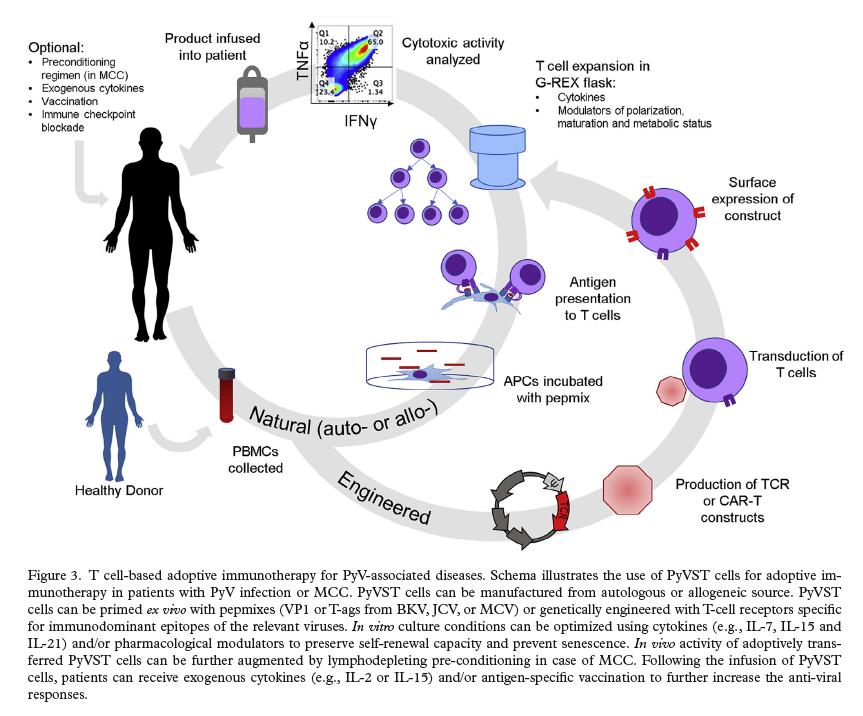 Tratamento (terapia celular) PyVST cells Células T Poliomavírus