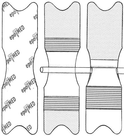 As abas de velcro podem ser abertas e fechadas