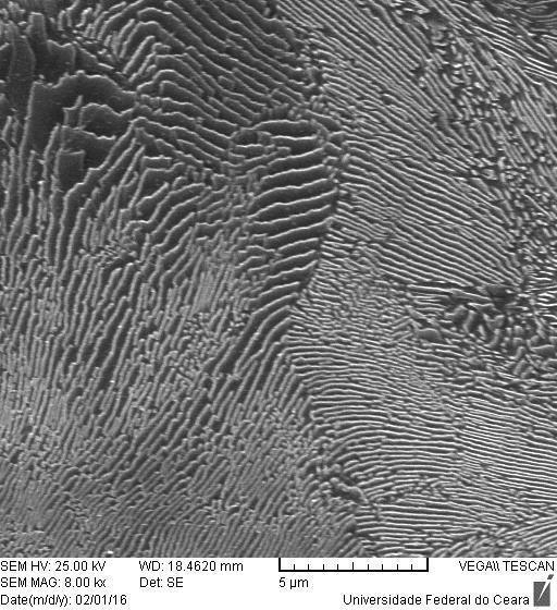 nital 2% por aproximadamente 5 segundo. a) b) Figura 9. Micrografia da amostra Normalizada após ataque químico com nital 2%. a) Aumento de 3000x.