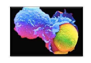 Da mesma forma que a Célula T CD8 citotóxica, a Célula NK também elimina a célula tumoral através de citocinas tóxicas. Figura 11 Macrófago (cor azul) fagocitando de uma célula tumoral (cor amarela).