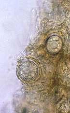 Oósporos de Phytophthora sojae no interior de