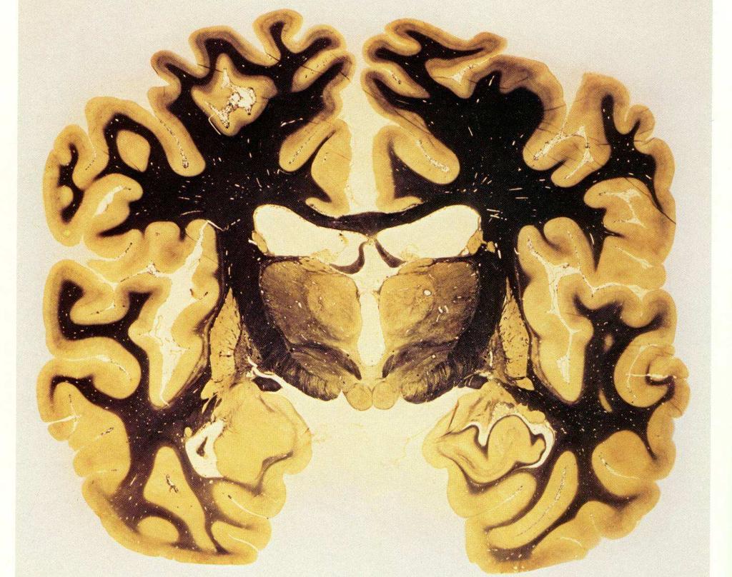 CÓRTEX CEREBRAL Sede dos fenômenos psíquicos. É uma fina camada de substância cinzenta que recobre o centro branco do cérebro.