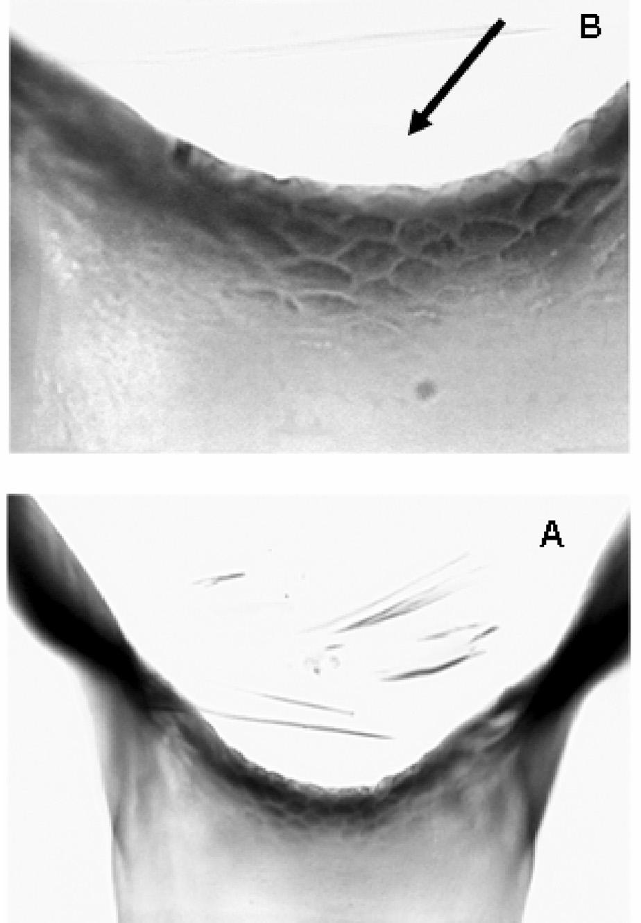 além de ser uma espécie cujas fêmeas possuem um tamanho grande, o que possibilita maior carga parasitária. Chave para as quatro espécies envolvidas na transmissão (segundo Py- Daniel,1997) de O.