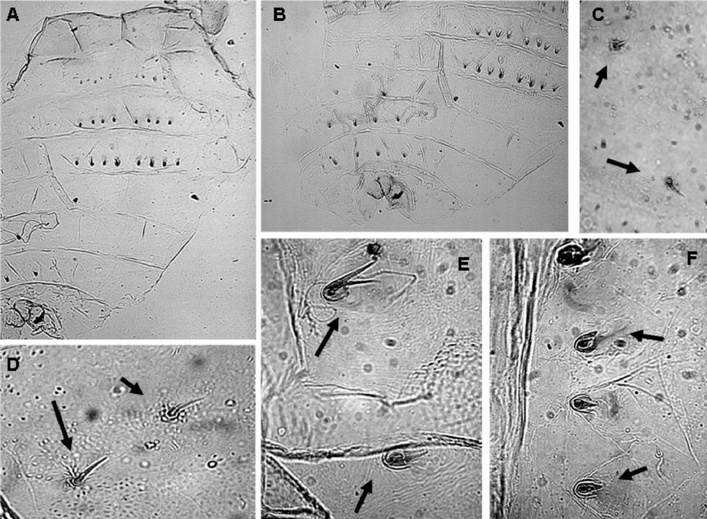 Figura 6 - Thyrsopelma jeteri sp.n. - pupa: a. tergitos abdominais; b. tergitos e esternitos abdominais; c.