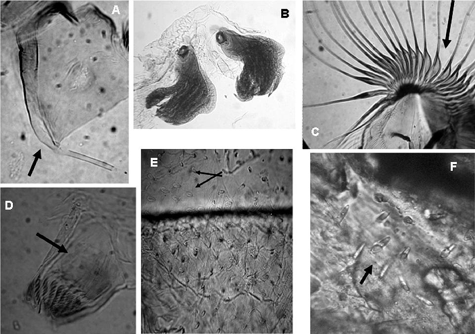 469 Figura 8 - Thyrsopelma jeteri sp.n. - larva: a. antena; b. histoblastos branquiais; c.