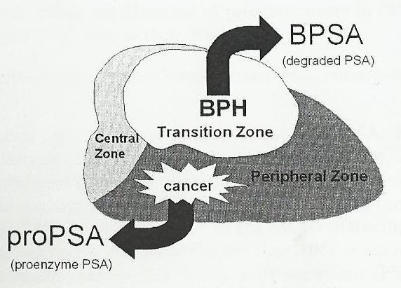 semelhante ao PSA nativo activo), PSA-B (associado a HBP) e o propsa (pró-enzima). Os dois primeiros estão aumentados na HBP e o último está ampliado no CaP.