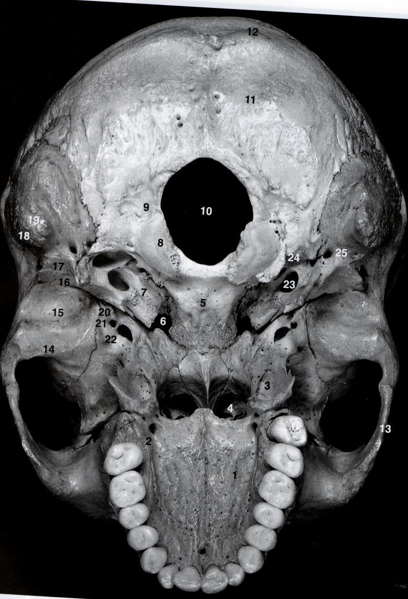 VII- Nervo Facial-intermédio Estrutura óssea: poro e