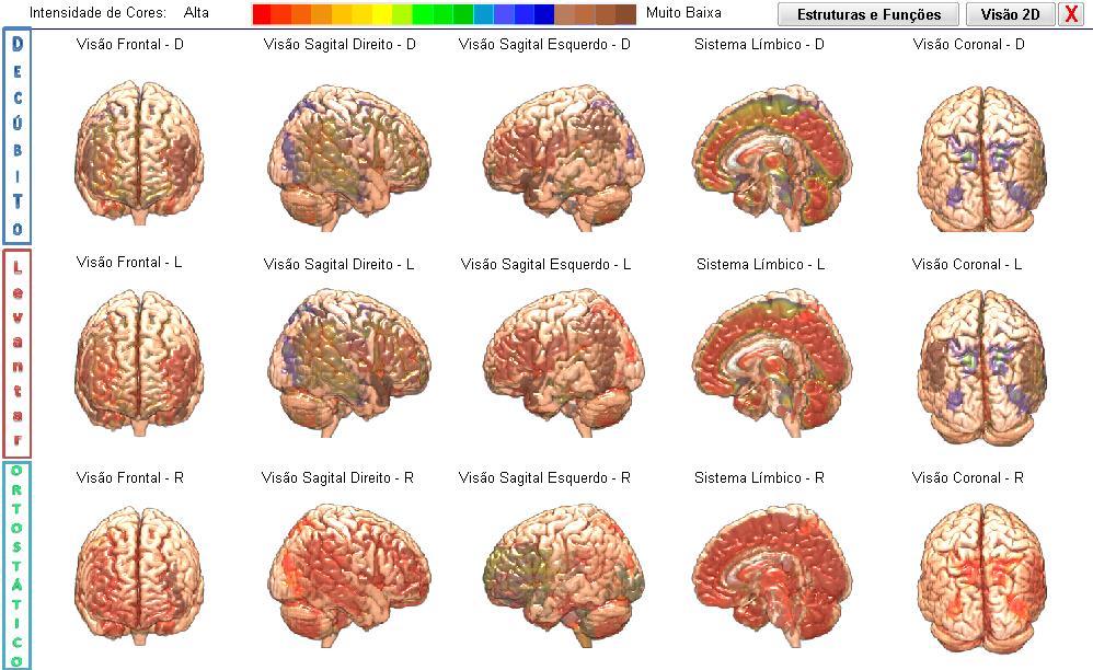 Capítulo 6 RELATÓRIO DE AVALIAÇÃO DAS IMAGENS MÉDICAS: Imagens Médicas em 3D nos ajuda a interpretar melhor o Cérebro Emocional e o Cérebro Racional, tendo em vista a competição e/ou os conflitos