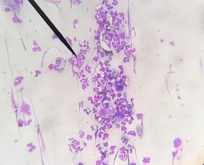 in vitro em amostras clínicas de cães com piodermite frente a 14 antibacterianos testados (CAVALCANTI; COUTINHO, 2005). Figura 2: Citologia aspirativa da lesão antes e após a corticoterapia.