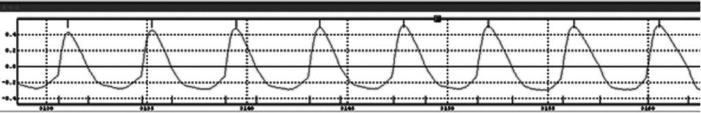 de 4,9 Hz para uma F0 média de 180 Hz oferece um coeficiente de variação de 2,7%. O mesmo desvio padrão para F0 média de 500 Hz fornece um coeficiente de variação de 0,98%, o que é mais significativo.
