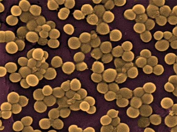 Staphylococcus aureus É a doença de origem alimentar mais comum e resulta da