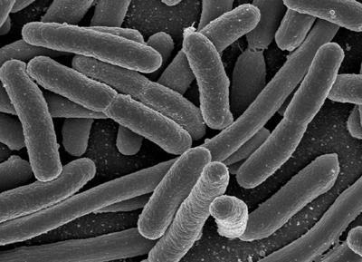 Escherichia coli Esta bactéria faz