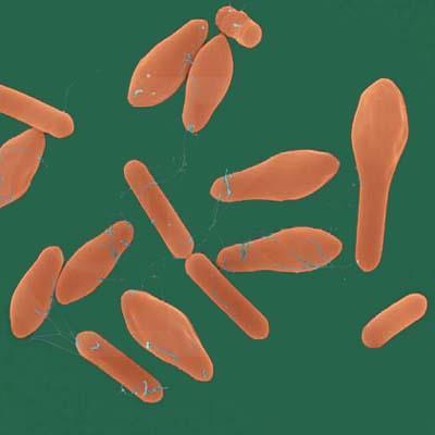 Clostridium botulinum Quando a bactéria anaeróbica encontra condições favoráveis de