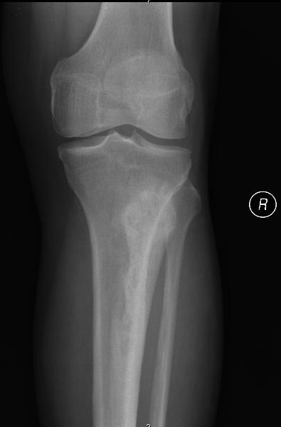 3.5 Radiografias aos joelhos obtidas na consulta