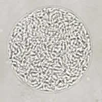 Toxoplasma gondii Bradizoitos