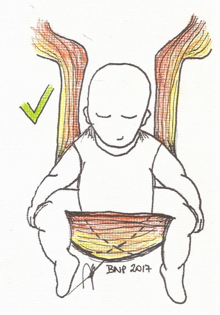 Exemplo visto de frente de como o tecido deve estar posicionado de joelho a joelho e entre o bebê e quem o carrega. Essa seria a visão do corpo do bebê voltado para o corpo do adulto que o carrega.