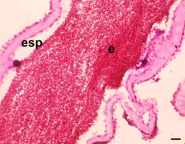 B - Presença de espermatozoa (espermatócitos (esp) evidentes).