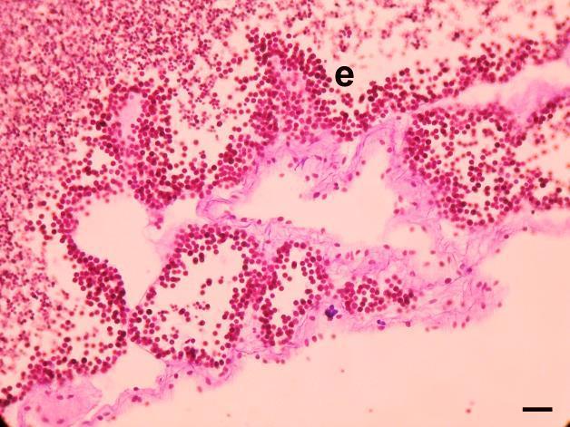 D - Testículos vazios (podem conter espermatozoa não libertado (e). Escala A: 18.6 µm; B: 55.4 µm; C: 32.1 µm; D: 23.8 µm.