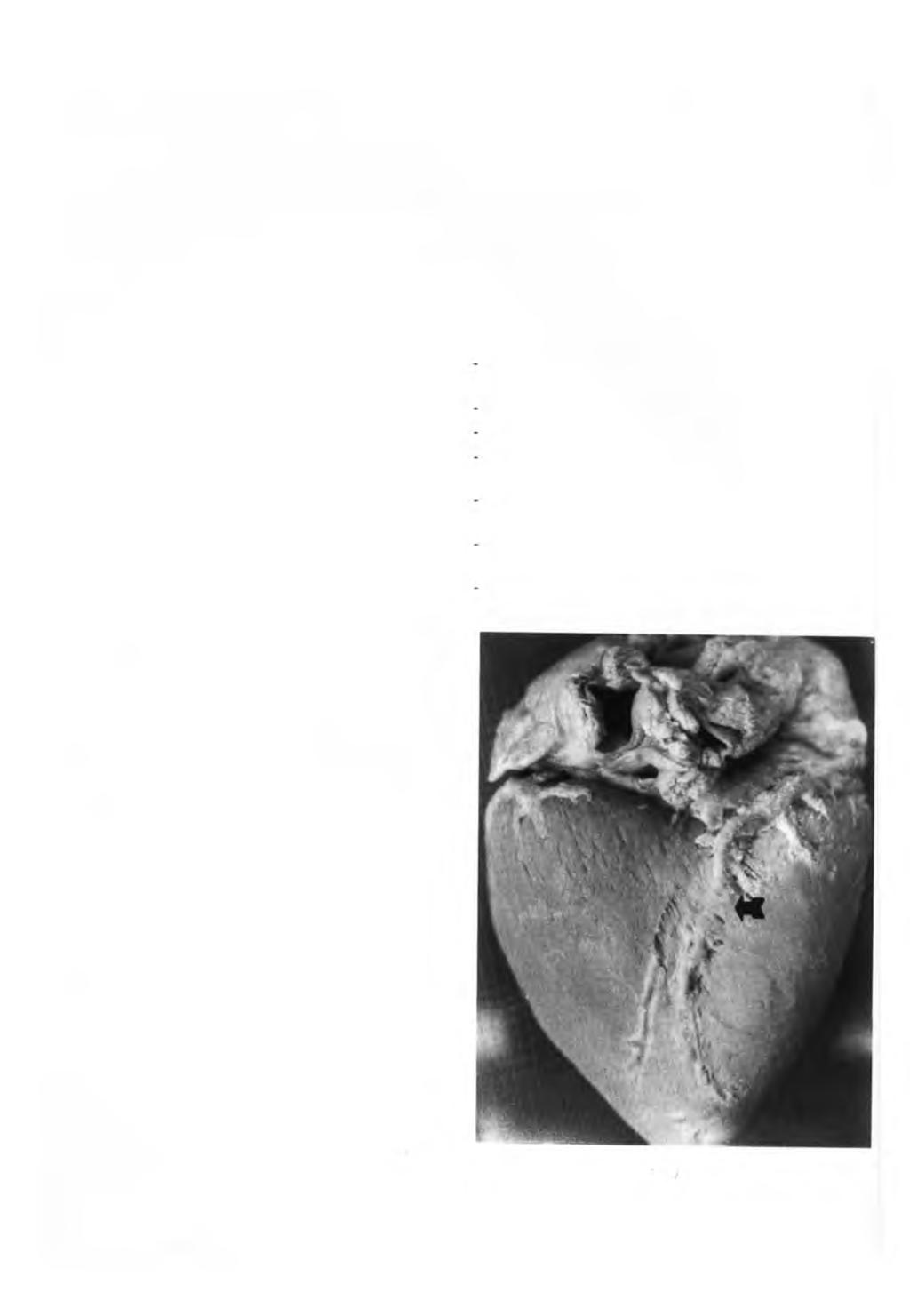BOMBONATO. P.P.; DOMINGOS, C.O.; MARIANA, A.N.B.; SILVA, F.O.C.; INTELIZANO, W. Ocorrência de pomes de miocárdio em suínos. Braz. J. vet. Res. anim. Sei., São Paulo, v.3 1,n.2,p. 107-11, 1994.