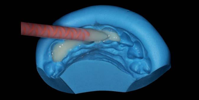 Figura 6 - Aspecto dos diastemas e alguns dentes com forma anatômica reduzida e um pouco girados.