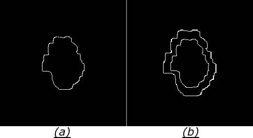 3.5 Pós-processamento do contorno inicial 62 Figura 3.19: Em (a) tem-se a curva inicial usada pelo modelo de contorno ativo e em (b) os marcadores para o método watershed. 3.5 Pós-processamento do contorno inicial Nesta seção descreve-se como foi desenvolvida a etapa de pós-processamento deste trabalho.