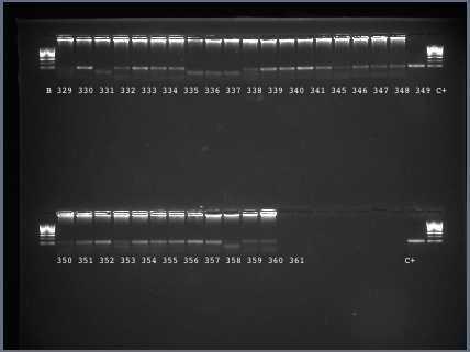 Resultados Biologia Molecular: PCR