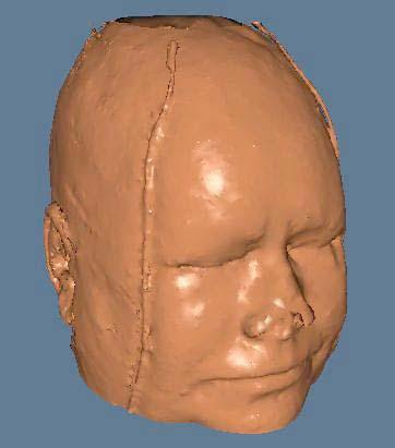 CAPÍTULO 3: FERRAMENTAS DE DESENVOLVIMENTO como reconstruiu a cabeça de um cadáver a partir de TACs utilizando o Visualization Toolkit, Figura 3.