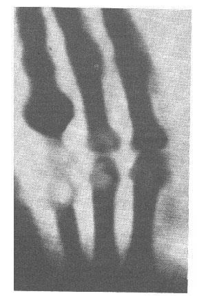 Radiografa (por 15 min) a mão da sua mulher.