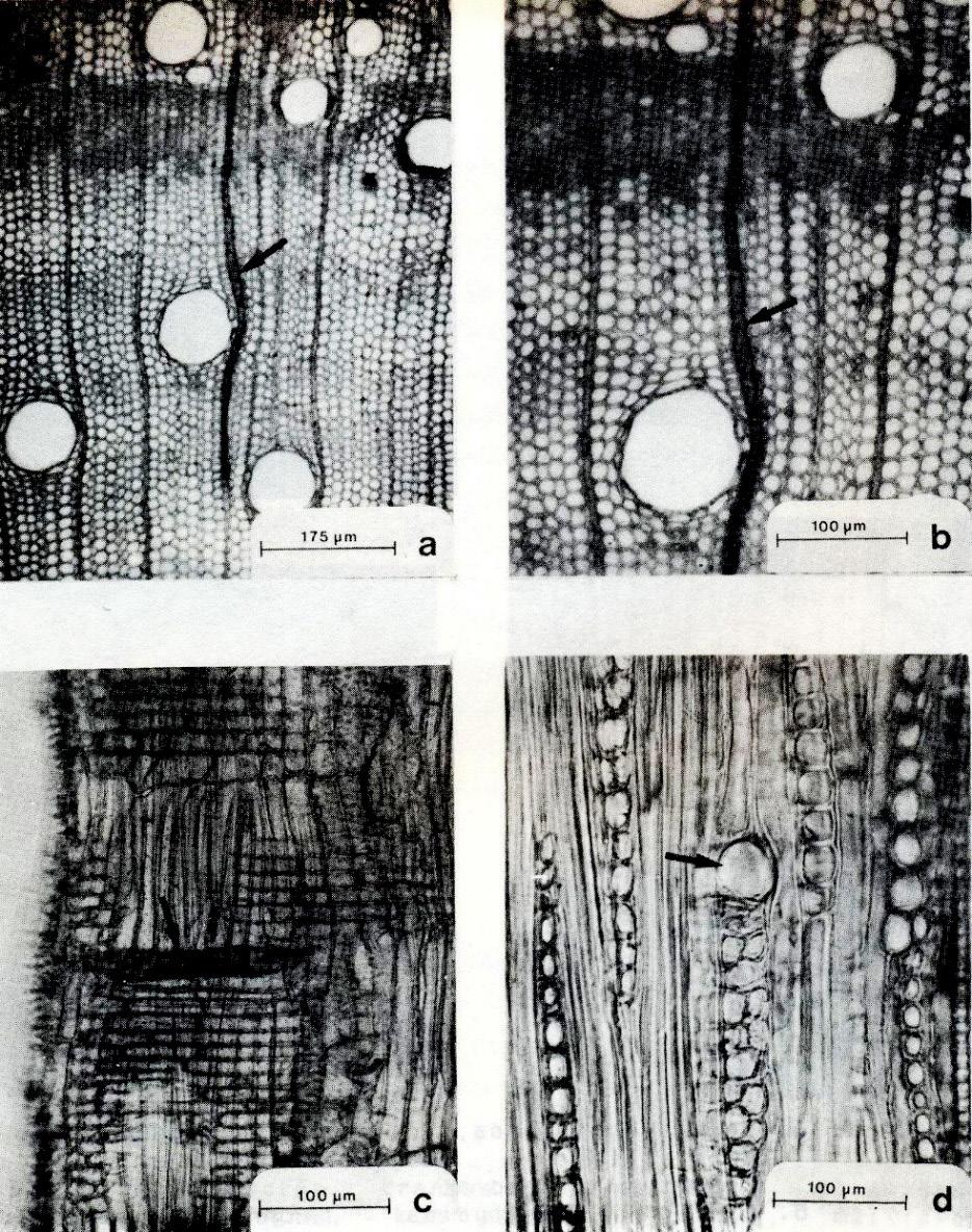 Anatomia da madeira de Acacia nitidifolia Speg. (Leguminosae... 57 FIGURA 3: A. Secção transversal, mostrando um canal radial (seta). B. Detalhe do mesmo canal celular radial. C.